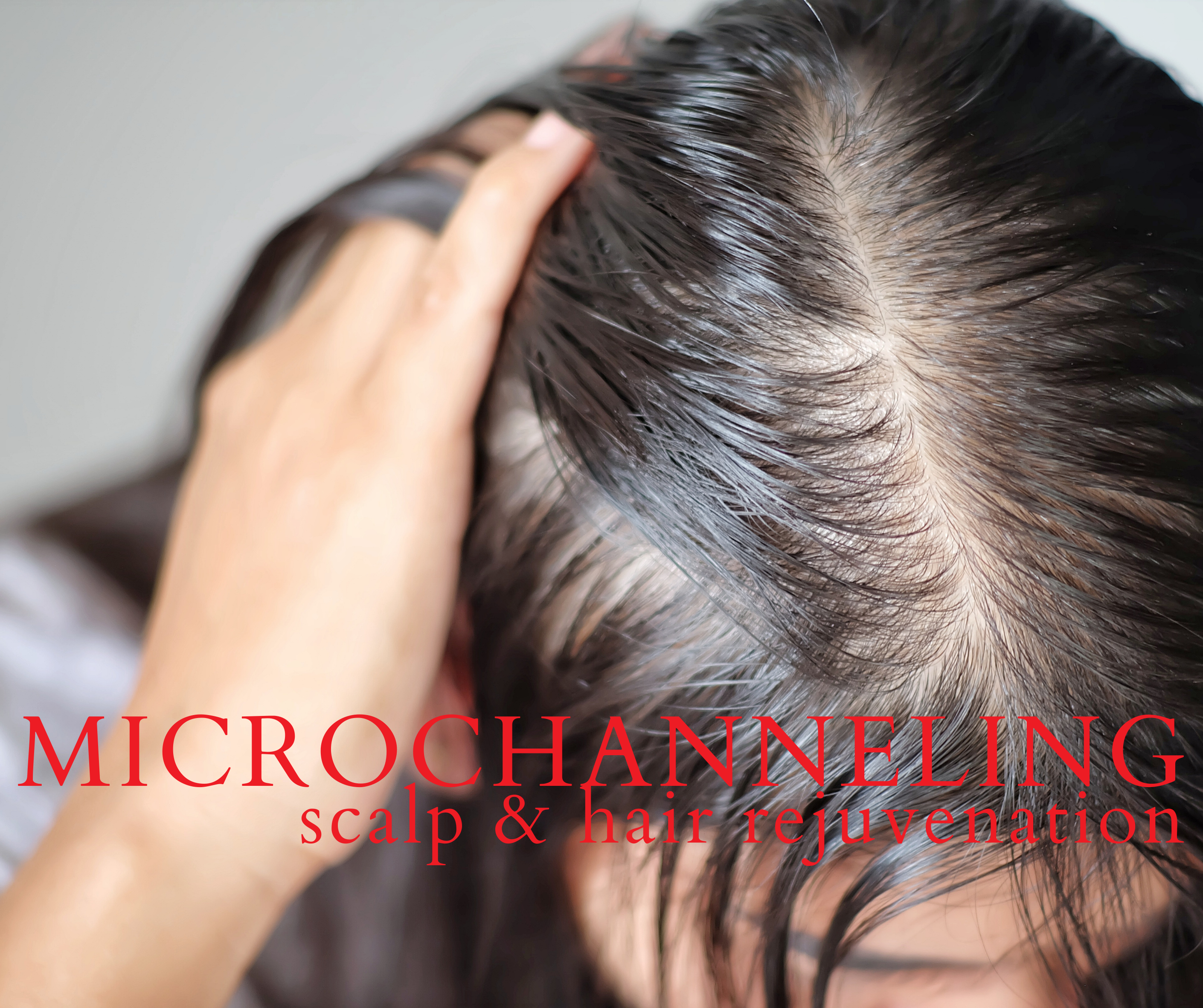 Microchanneling Scalp & Hair Rejuvenation
